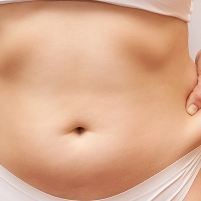 Hidrolipo: conheça esse tipo de lipo e para quando ela é indicada